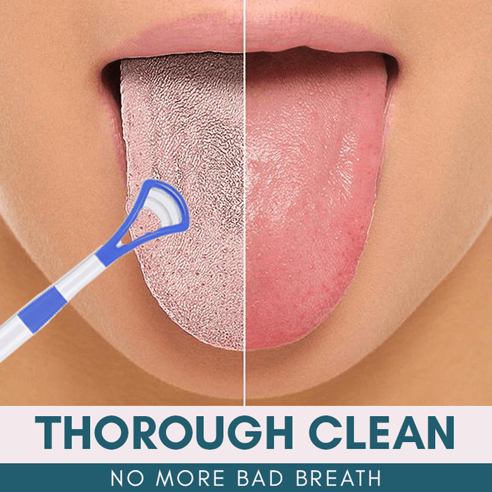BreathRefresh Tongue Scraping Cleaner