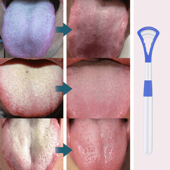 BreathRefresh Tongue Scraping Cleaner
