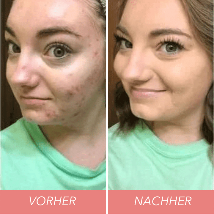 On Promotionš„š„Buy 1 Tri-Color Concealer Get 1 Invisible Waist Belts Free !!