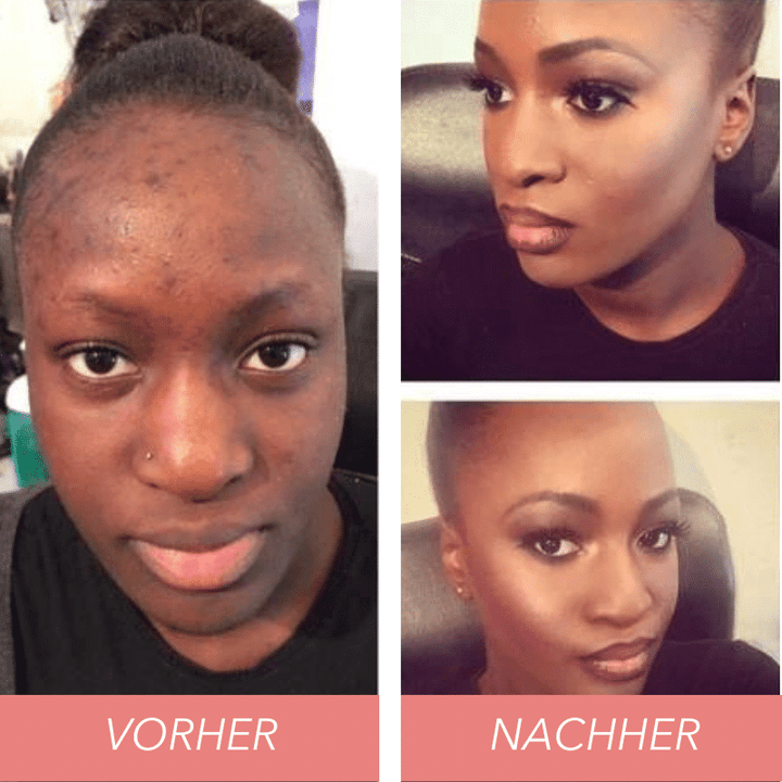 On Promotion🔥🔥Buy 1 Tri-Color Concealer Get 1 Invisible Waist Belts Free !!