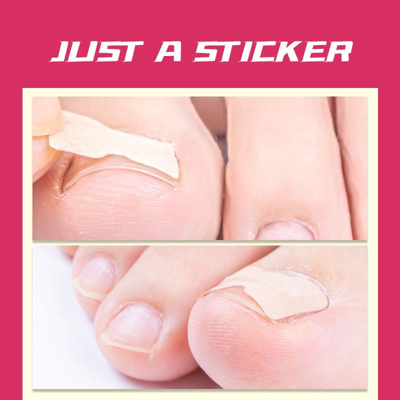 🔥 Glue Free Toenail Patch