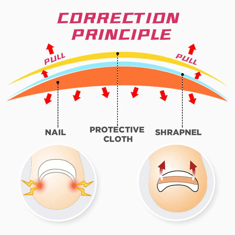 🔥 Glue Free Toenail Patch